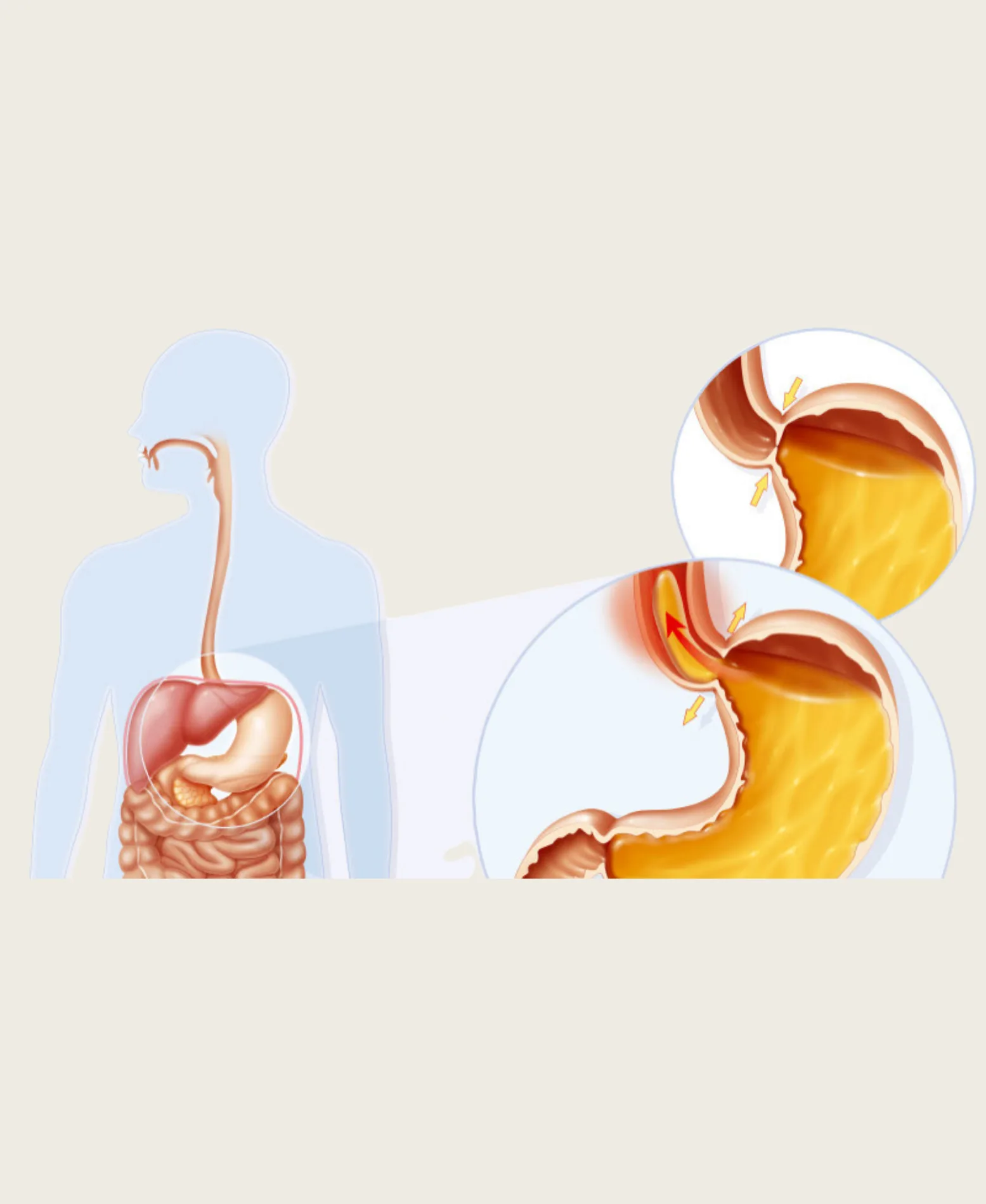 Dr. Neel Patel - Stomach & Esophageal care at Niraaya Hospital Gandhinagar